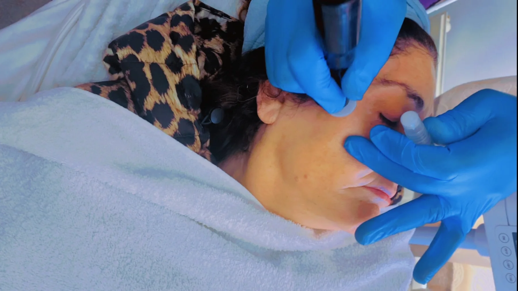 Procell treatment in progress