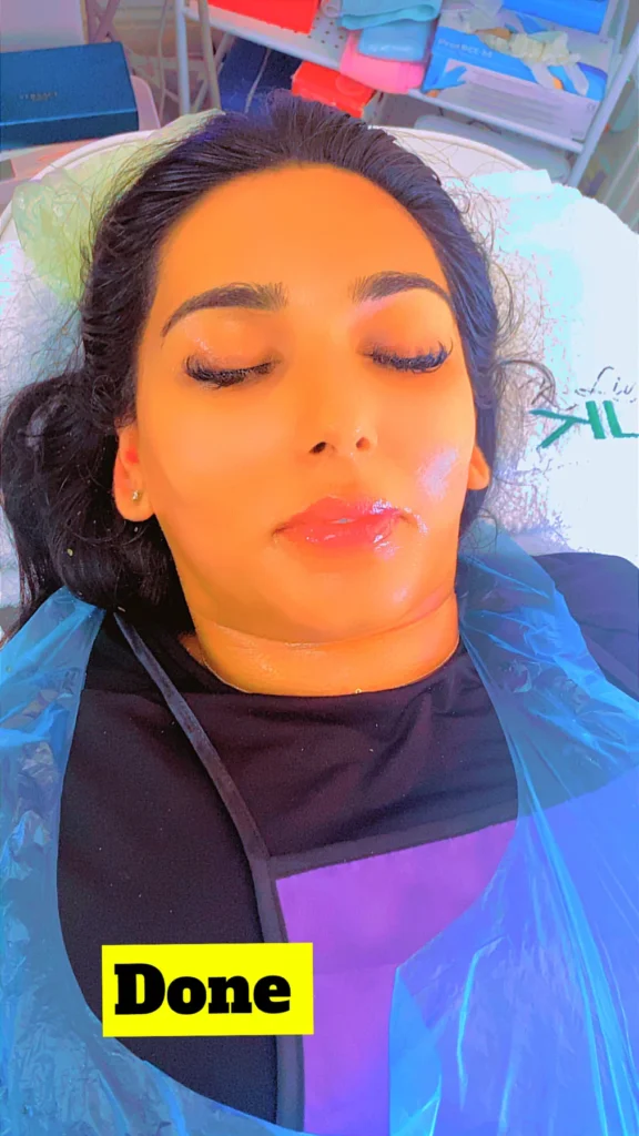 Herbal Peeling Face